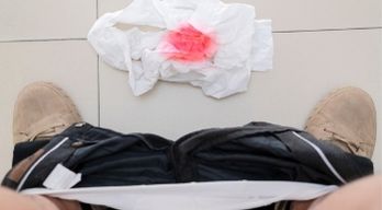 ริดสีดวงทวารสามารถแบ่งออกเป็น 3 ประเภท